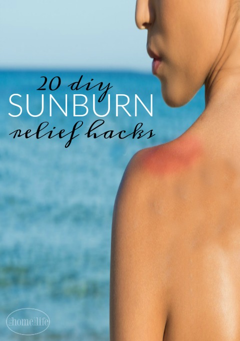 DIY SUNBURN RELIEF via www.firsthomelovelife.com